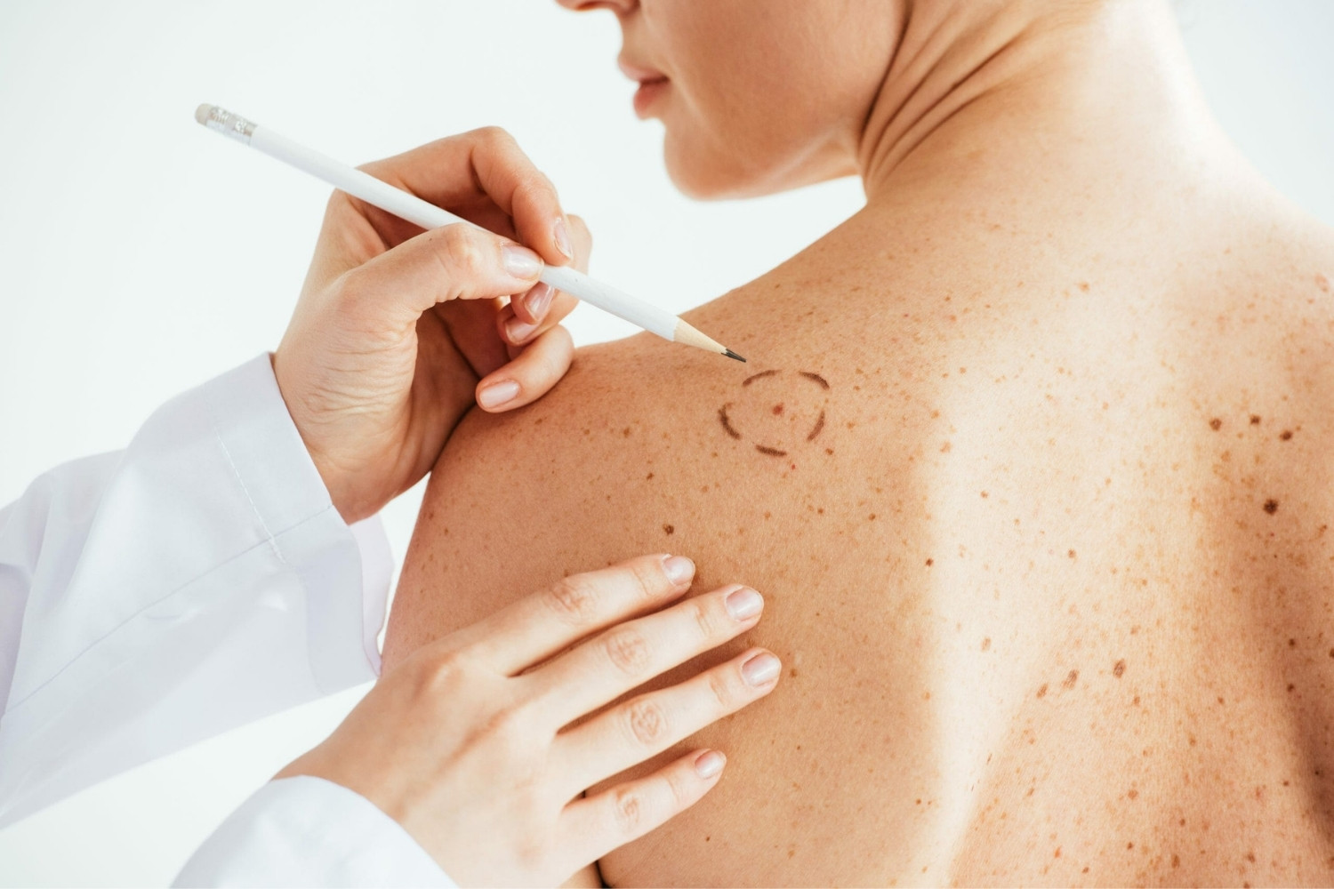 dermatology-quiz