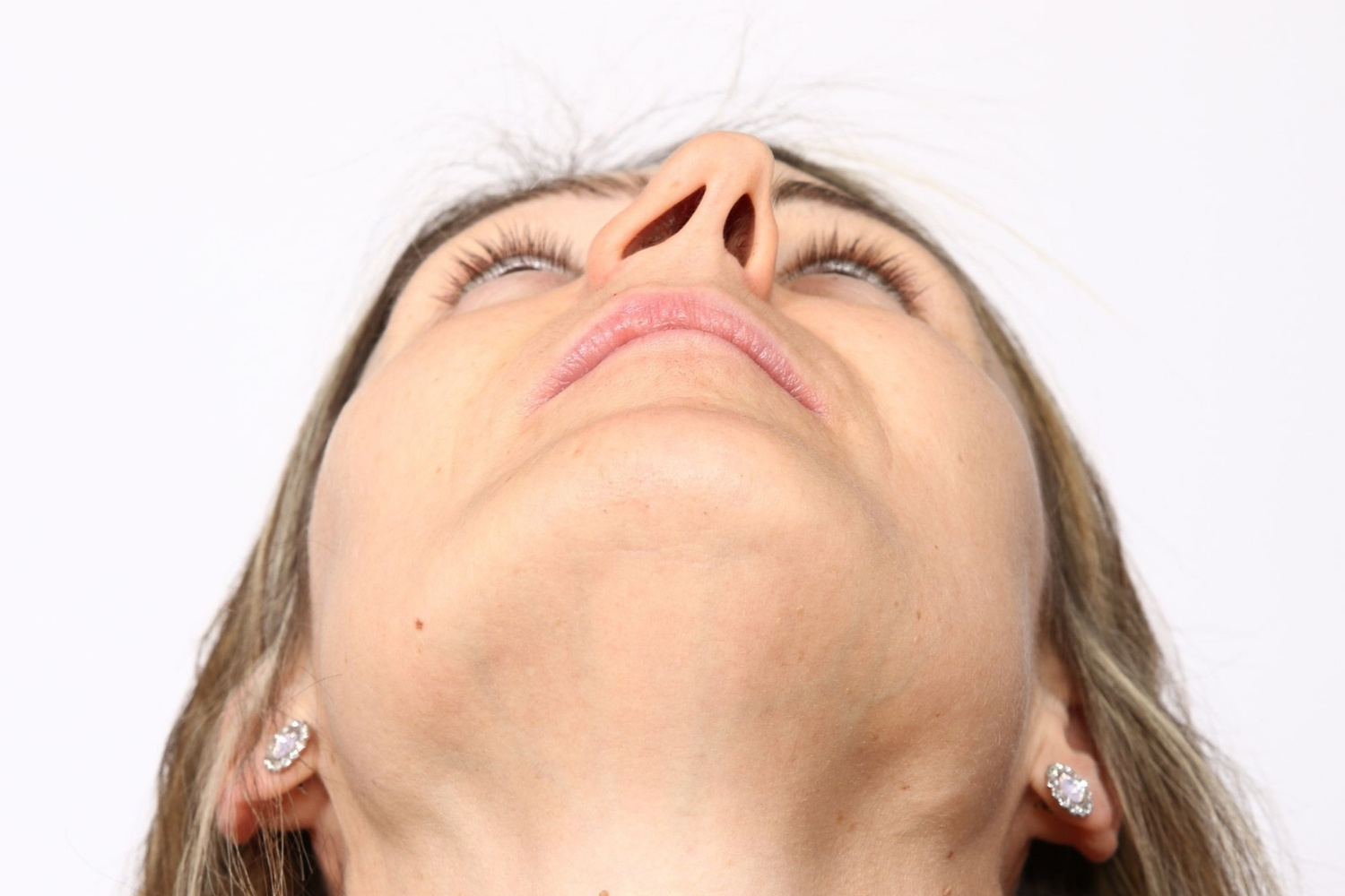 deviated-septum-quiz